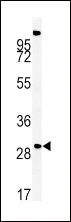 Polyclonal Rabbit anti-Human ZDHHC21 Antibody (aa59-87, IHC, WB)