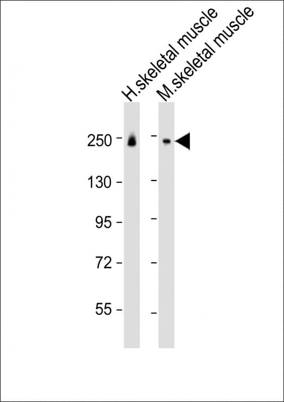 MYH8 Antibody (aa13-37)