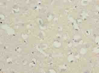 C3orf18 Antibody