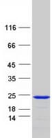 Human SNX12 Protein (Recombinant Myc-DDK (Flag))