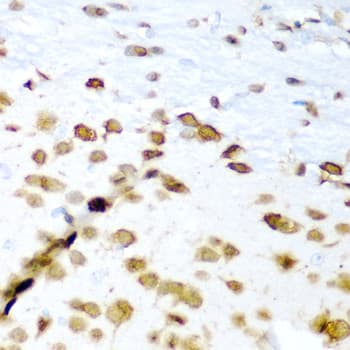 ELAVL3 / HUC Antibody