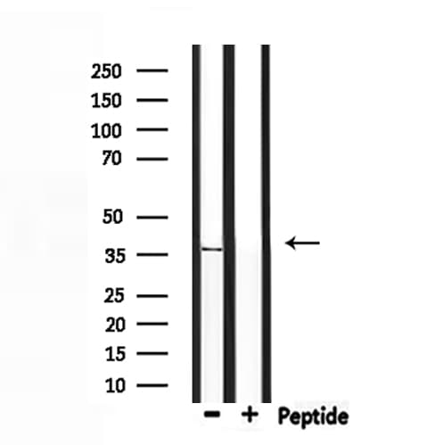 OR5V1 Antibody