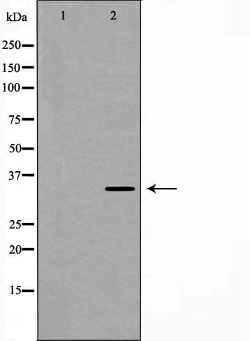 ATP1B1 Antibody
