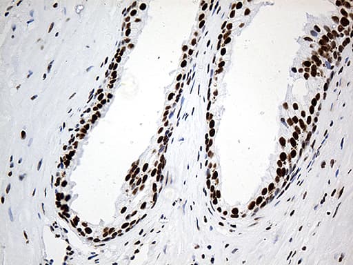 HNRNPH1 / hnRNP H Antibody (clone OTI5D11)