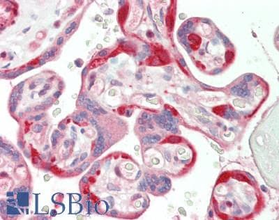 IHC-plus™ Polyclonal Rabbit anti-Human FAK / Focal Adhesion Kinase Antibody (aa373-422, IHC, WB)
