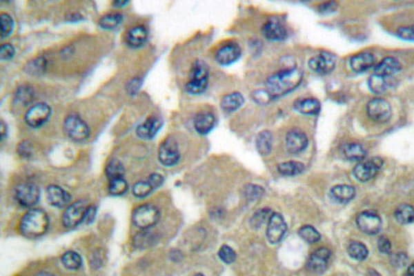 MMP9 / Gelatinase B Antibody (Trp680)