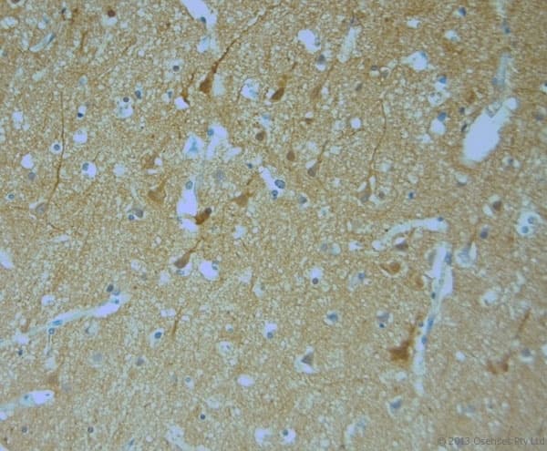 Polyclonal Rabbit anti-Human MPP1 Antibody (aa410-460, IHC)