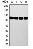 Polyclonal Rabbit anti-Human ATRIP Antibody (N-Terminus, IHC, IF, WB)