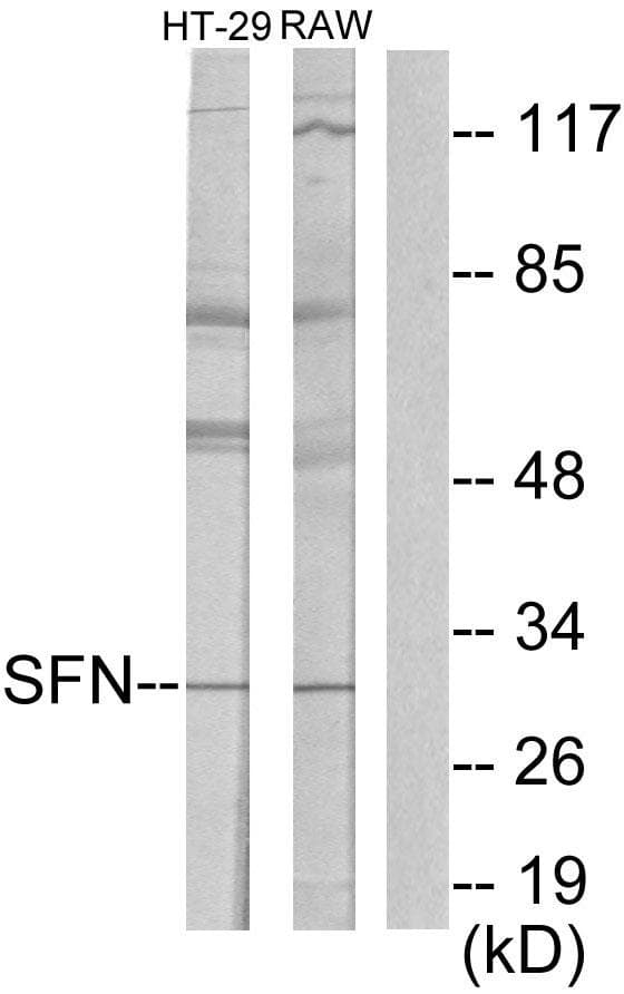 SFN / Stratifin / 14-3-3 Sigma Antibody