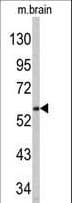 Polyclonal Rabbit anti-Human Syndapin I / PACSIN1 Antibody (aa8-38, IHC, WB)