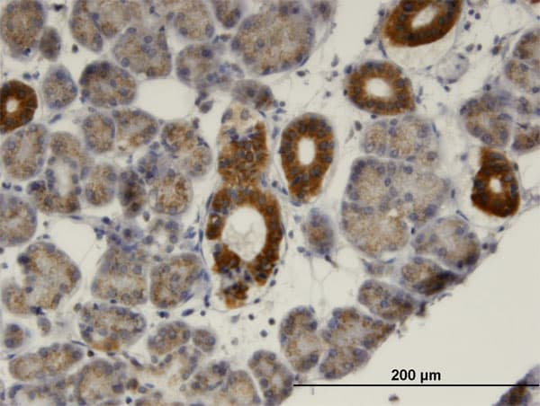 MVK Antibody (clone 2C5)