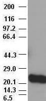 NOG / Noggin Antibody (clone OTI1H8)