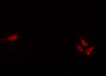 Polyclonal Rabbit anti-Human HEN1 + HEN2 Antibody (IF, WB)
