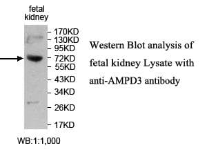 IHC-plus™ AMPD3 Antibody (aa541-776)