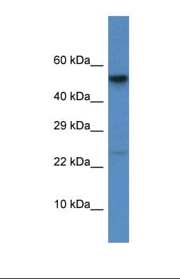 CTSC / Cathepsin C / JP Antibody (aa151-200)