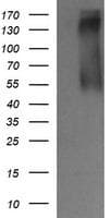 Monoclonal Mouse anti-Human ERBB2 / HER2 Antibody (clone OTI4G7, Carrier-free, aa676-1255, IHC, WB)