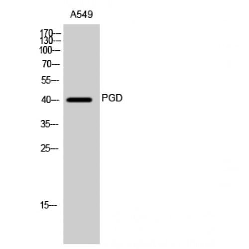 PGD Antibody (40-120 aa, Internal)