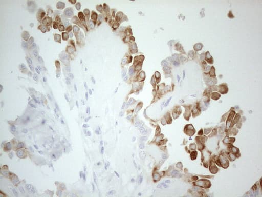 ERBB3 / HER3 Antibody (aa983-1342, clone OTI3C1, Carrier-free)
