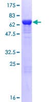 Human TBC1D13 Protein (Recombinant GST)