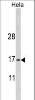 Polyclonal Rabbit anti-Human MPV17 Antibody (aa24-50, IHC, WB)