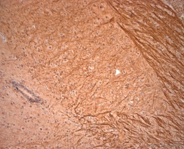 NEFH / NF-H Antibody (aa150-200)