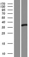 SH2D4B Protein (Over-Expression Lysate Myc-DDK (Flag))