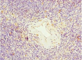 TFCP2 / CP2 Antibody