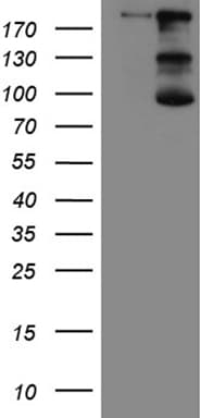 IQGAP1 Antibody (aa464-609, clone OTI5F9, Carrier-free)