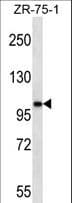 Polyclonal Rabbit anti-Human AR / Androgen Receptor Antibody (aa475-504, WB)
