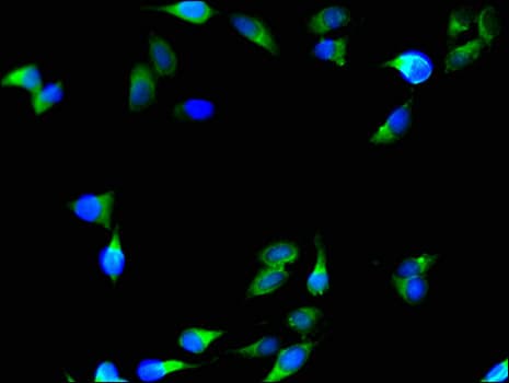 Polyclonal Rabbit anti-Human C1QTNF9B Antibody (IHC, IF)