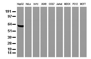 Alpha-Fetoprotein Antibody (clone UMAB66, Carrier-free)