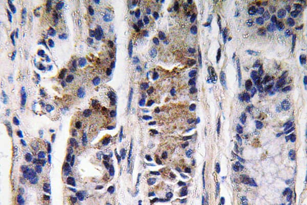 PGC / Pepsin C Antibody (aa257-306)