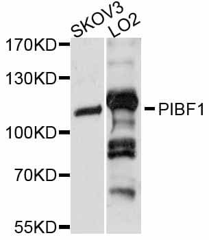 PIBF1 / PIBF Antibody