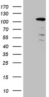 KIAA1524 / p90 Autoantigen Antibody (aa635-905, clone OTI2A1, Carrier-free)