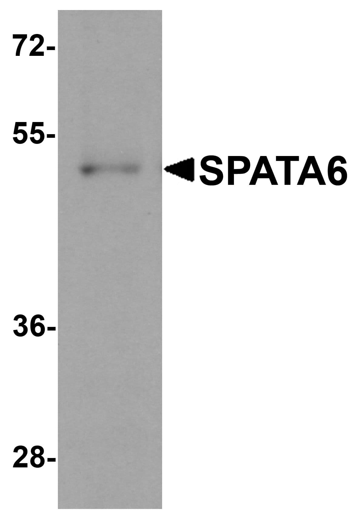 SPATA6 / SRF-1 Antibody