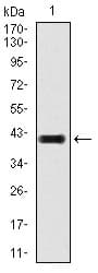 TGFB1 / TGF Beta 1 Antibody (clone 7F6)