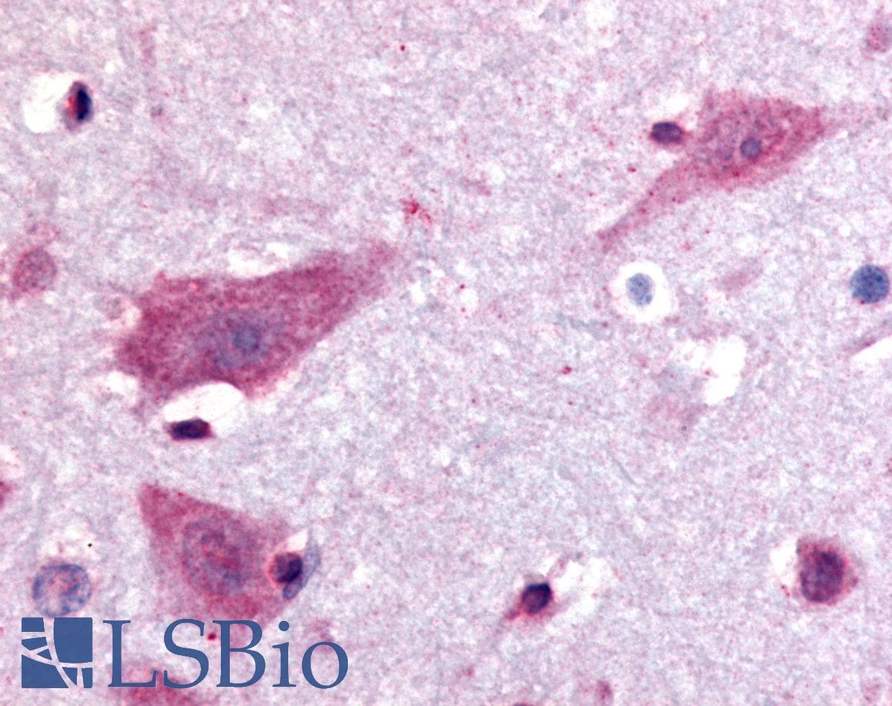 IHC-plus™ Dipeptidylpeptidase 10 / DPP10 Antibody (Extracellular Domain)