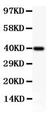 NFKB2 Antibody (aa1-340)