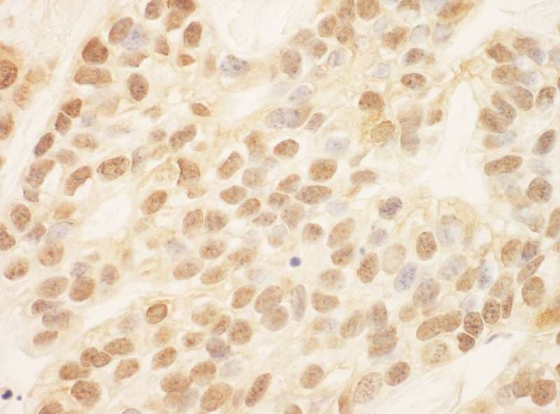 ZEB2 / SIP-1 Antibody (aa750-800)