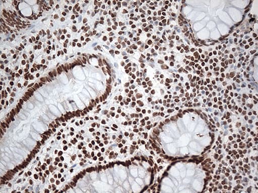 EWSR1 / EWS Antibody (aa256-447, clone OTI2D9, Carrier-free)