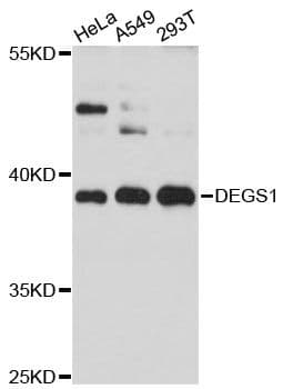Polyclonal Rabbit anti-Human DEGS1 Antibody (WB)
