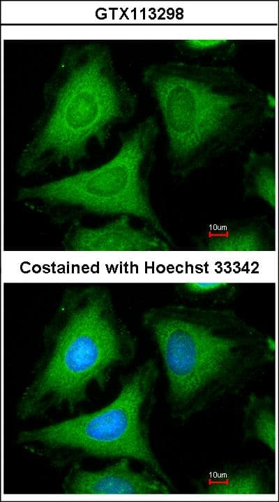 YWHAG / 14-3-3 Gamma Antibody
