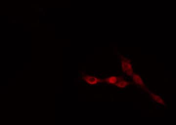 Polyclonal Rabbit anti-Human CEP170 Antibody (IHC, IF, WB)