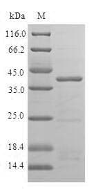 Human ISCU Protein (Recombinant GST, N-terminus)