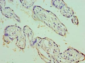 Polyclonal Rabbit anti-Human ECE-1 Antibody (aa471-770, IHC)