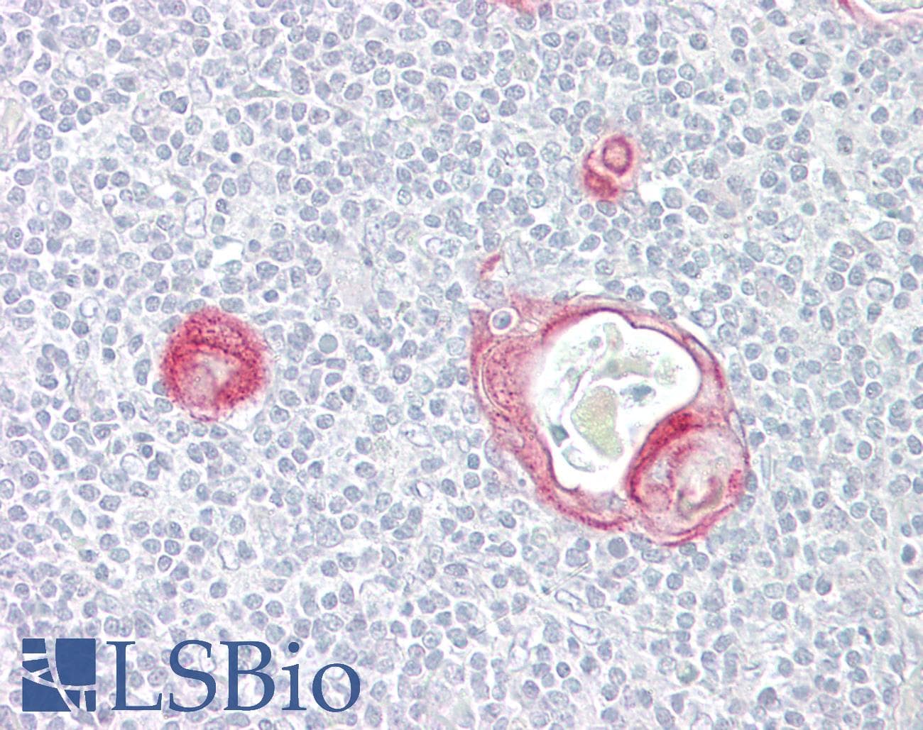 IHC-plus™ MAP3K5 / ASK1 Antibody (aa49-98)