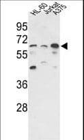 IHC-plus™ PPP3CC / CALNA3 Antibody (aa18-47)