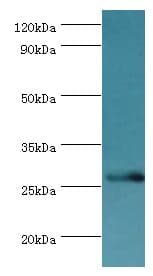 Polyclonal Rabbit anti-Human BIRC8 / ILP2 Antibody (aa1-236, WB)