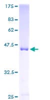 Human SHOOTIN1 / KIAA1598 Protein (Recombinant GST)