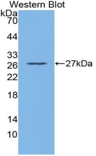 GSTT2 Antibody (aa15-216)